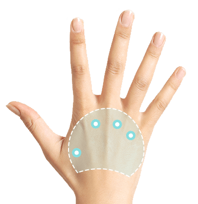 Hand Rejuvenation | SLC | Utah Facial Plastics