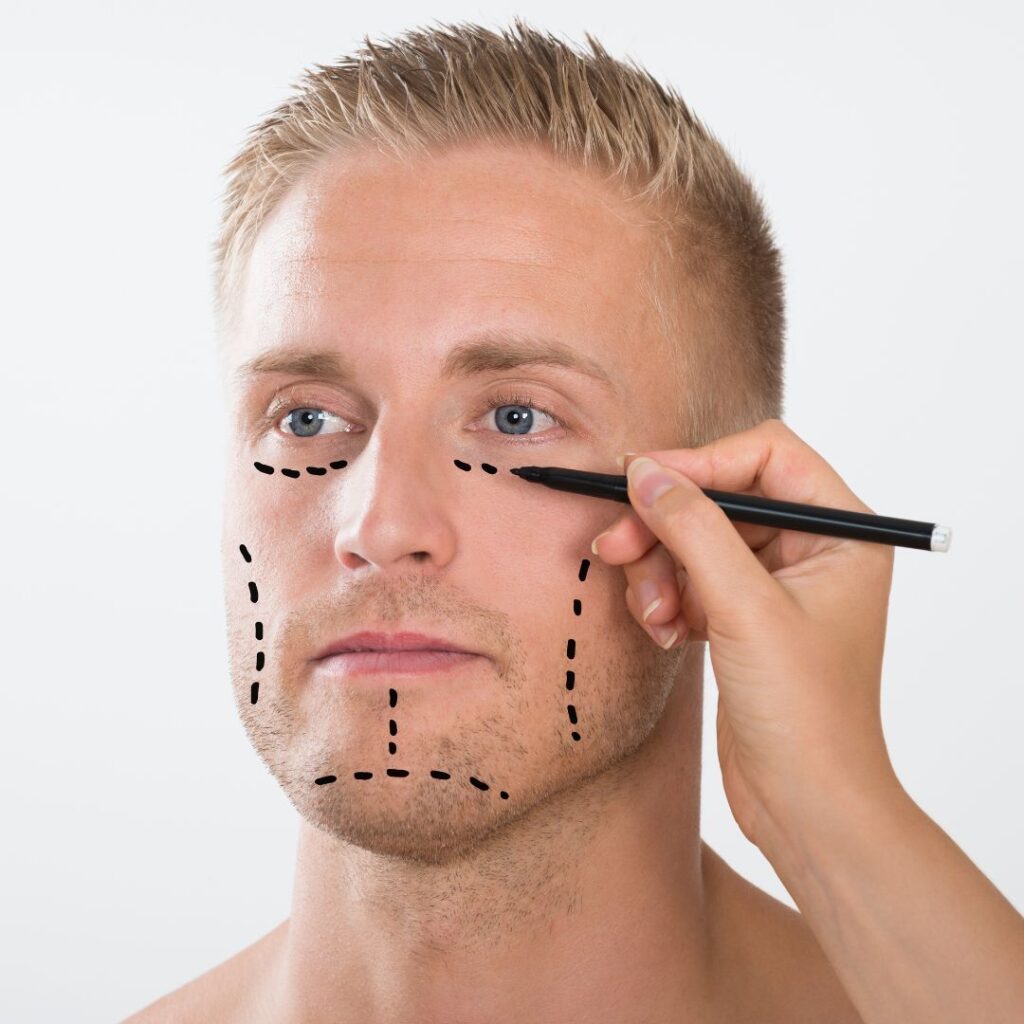 men cosmetic surgery